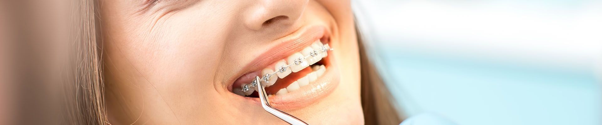تخصص تقويم الاسنان